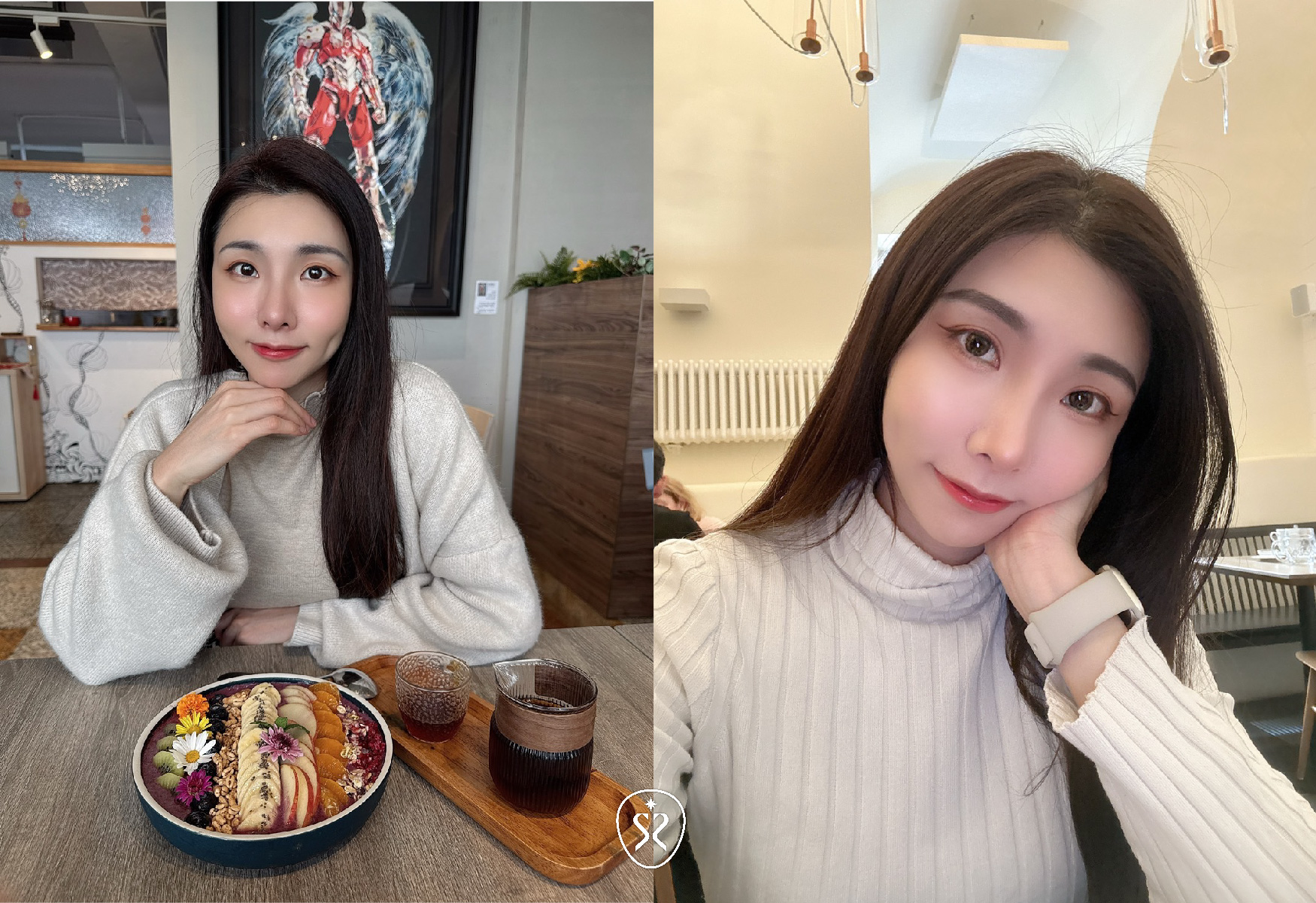 肉毒水光注射術後皮膚緊緻服貼成果